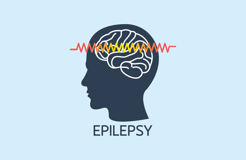 Can you get a job if you have epilepsy?